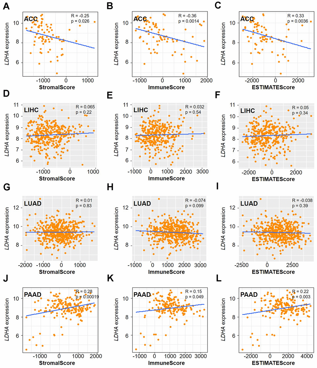 Correlation analysis of LDHA expression with TME in multiple cancers. The correlation of LDHA expression with stromal score, immune score, and ESTIMATE score in ACC (A–C), LIHC (D–F), LUAD (G–I), and PAAD (J–L). Gray brown background indicates no significant correlation between the gene expression and the corresponding index (p >0.05). Light background indicates that the gene is significantly correlated with the corresponding index (p 0 means positive correlation, R 