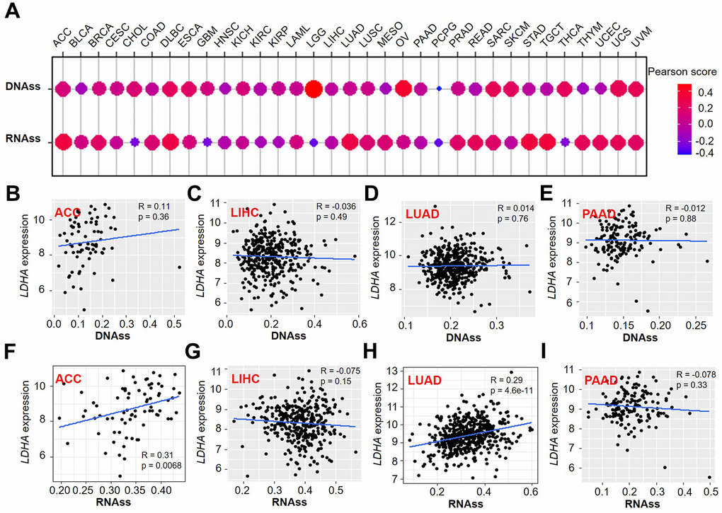 Association of LDHA expression with stemness score in pan-cancer. (A) The correlation of LDHA expression with DNAss and RNAss. (B–E) LDHA expression correlated with DNAss in ACC, LIHC, LUAD, and PAAD. (F–I) The expression of LDHA correlated with RNAss in ACC, LIHC, LUAD, and PAAD. Gray brown background indicates no significance between the gene expression and the corresponding index (p >0.05). Light background indicates that the gene is significantly correlated with the corresponding index (p 0 means positive correlation, R 
