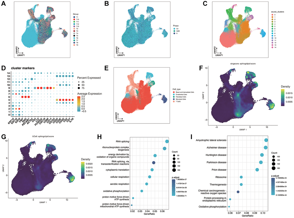 Analysis of single-cell sequencing data for prostate cancer. (A, B) Quality control and sample integration. (C–E) The dimensionality reduction clustering was performed on all cells. All cells are grouped into 15 clusters. After annotating the different clusters, a total of five cell types were obtained. (F, G) A sphingolipid metabolism score was performed. (H, I) Gene enrichment analysis between high sphingolipid metabolism score group and low sphingolipid metabolism score group.