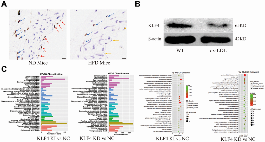 Analysis of KLF4 protein expression and EC dysfunction. (A) Immunohistochemical detection of vascular wall KLF4 expression. Scale bar, 20 μm. Representative images (n=5) are shown. Red arrow, KLF4 expression in the intima of mice fed a normal diet. Yellow arrow, intima lacking KLF4 expression in mice fed a high-fat diet. Blue arrow, KLF4 expression in adventitial fibroblasts. (B) Western blotting analysis of KLF4 protein expression in cultured HUVECs (100 μg/ml ox-LDL, 24 h) (n=5). (C) GO and KEGG analysis of the pathways after KLF4 knock in and knock out in HUVECs.