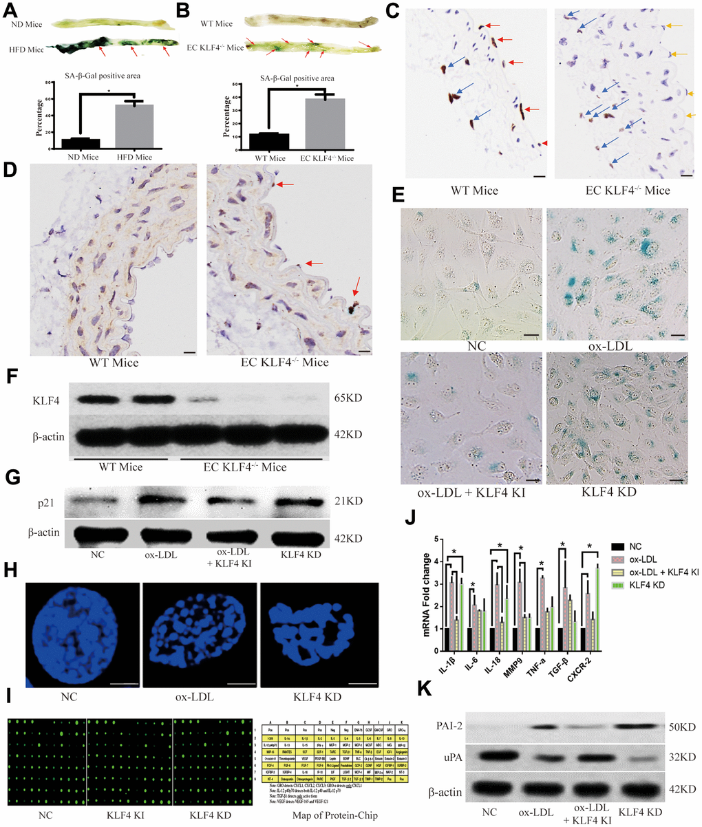 KLF4 inhibits the EC SASP. (A) Histochemical detection of the SA-β-gal-positive area in the vascular wall of mice fed a high-fat diet. Representative images (n=5) are shown. Red arrow, SA-β-gal-positive intima. (B) Immunohistochemical detection demonstrates the efficiency of specific conditional KLF4 knockout in mouse endothelial cells (EC KLF4-/-). Scale bar, 200 μm. Representative images (n=5) are shown. Red arrow, KLF4 expression in normal mouse intima. Yellow arrow, intima lacking KLF4 expression in mice fed a high-fat diet. Blue arrow, KLF4 expression in adventitial fibroblasts. (C) Histochemical detection of SA-β-gal-positive areas in the vascular wall of EC KLF4-/- mice. Scale bar, 1 cm. Representative images (n=5) are shown. Red arrow, SA-β-gal-positive intima. (D) Immunohistochemical detection of p21 protein expression in the intima of EC KLF4-/- mice. Scale bar, 200 μm. Representative images (n=5) are shown. Red arrow, p21-positive endothelial cells. (E) Histochemical detection of SA-β-gal-positive ECs in HUVECs. Scale bar, 50 μm. Representative images (n=5) are shown. Blue, SA-β-gal-positive ECs. (F) Western blotting analysis of KLF4 protein expression in the intima of EC KLF4-/- mice. (G) Western blotting analysis of p21 protein expression in HUVECs after KLF4 expression is altered (n=5). (H) Immunofluorescence detection of typical SAHF formation in HUVECs (n=5). Scale bar, 5 μm. (I) Protein chip analysis in HUVECs (n=3). (J) qPCR analysis of the mRNA levels of cytokines in HUVECs (n=5). *P K) Western blotting analysis of PAI-2 and uPA protein expression in HUVECs (n=5).