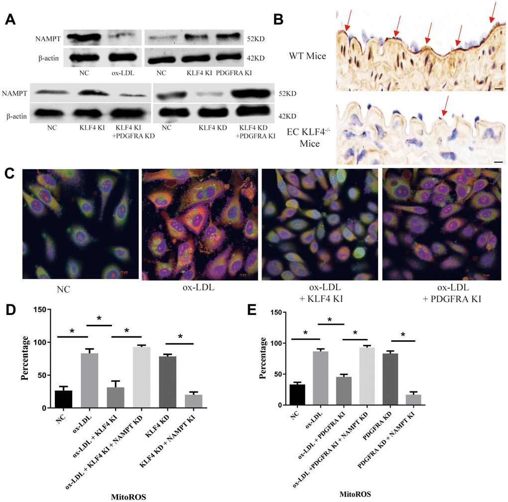 KLF4/PDGFRA regulated NAMPT/MitoROS expression. (A) Western blotting analysis of NAMPT protein expression in cultured HUVECs (n=5). (B) Immunohistochemical detection of NAMPT protein expression in the intima of high-fat diet-fed mice or EC KLF4-/- mice. Scale bar, 200 μm. Representative images (n=5) are shown. Red arrow, NAMPT-positive endothelial cells. (C) Immunofluorescence detection of MitoROS in cultured HUVECs. Scale bar, 20 μm. Representative images (n=5) are shown. Red, ROS. Green, Mitochondria. Yellow, MitoROS. (D) Flow cytometry analysis for MitoROS quantification in KLF4-treated HUVECs after altering NAMPT expression (n=5). *P E) Flow cytometry analysis of MitoROS quantification in PDGFRA-treated HUVECs after altering NAMPT expression (n=5). *P 