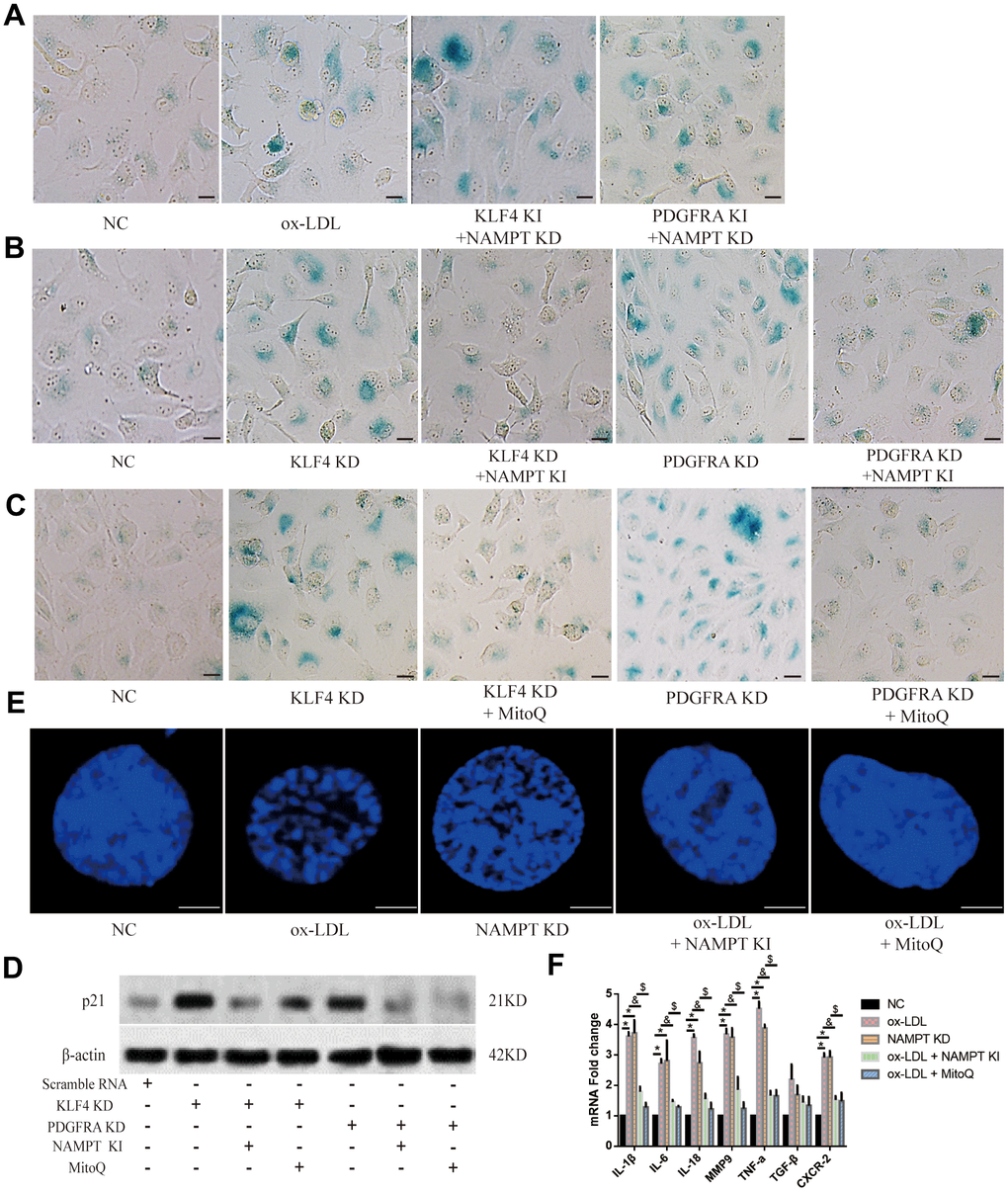 NAMPT/MitoROS regulated the SASP in HUVECs. (A) Histochemical detection of SA-β-gal-positive ECs in NAMPT knockdown HUVECs after knock-in of KLF4 or PDGFRA. Scale bar, 50 μm. Representative images (n=5) are shown. Blue, SA-β-gal-positive ECs. (B) Histochemical detection of SA-β-gal-positive ECs in NAMPT knock-in HUVECs after KLF4 or PDGFRA knockdown. Scale bar, 50 μm. Representative images (n=5) are shown. Blue, SA-β-gal-positive ECs. (C) Histochemical detection of SA-β-gal-positive ECs in MitoQ-treated HUVECs after KLF4 or PDGFRA knockdown. Scale bar, 50 μm. Representative images (n=5) are shown. Blue, SA-β-gal-positive ECs. (D) Western blotting analysis of p21 protein expression in NAMPT knock-in- or MitoQ-treated HUVECs (n=5). (E) Immunofluorescence detection of typical SAHF formation in cultured HUVECs after altering NAMPT expression or treatment with MitoQ (n=5). Scale bar, 20 μm. (F) qPCR analysis of cytokine mRNA levels in cultured HUVECs after altering NAMPT expression or treatment with MitoQ (n=5). *P 