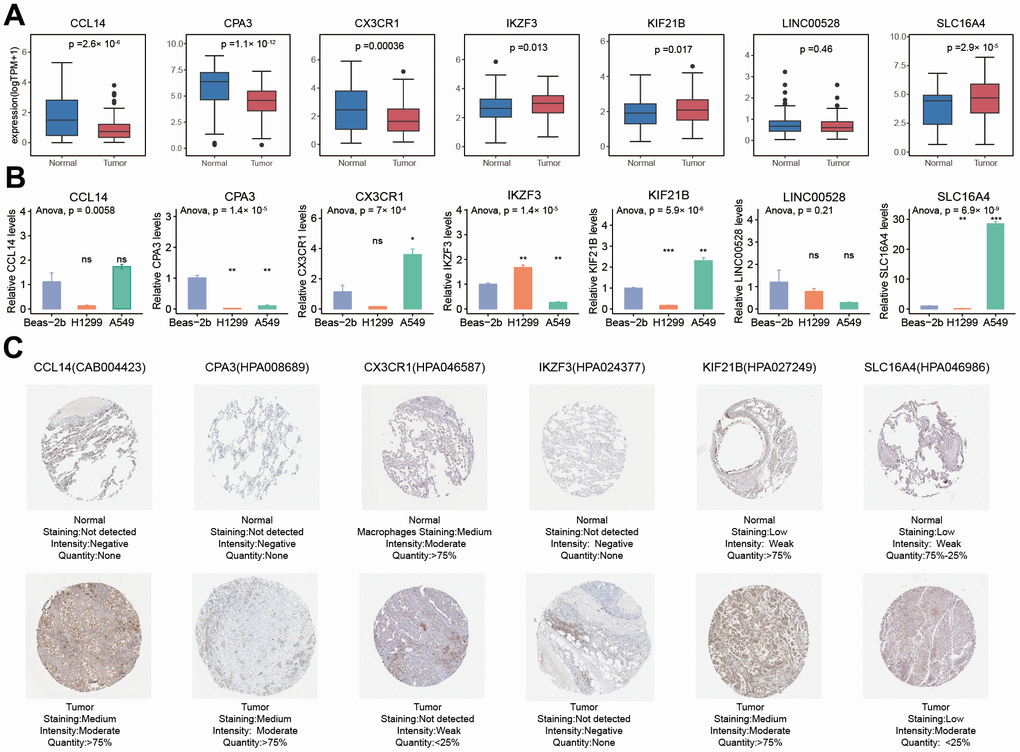 Comparison analysis of the expression of seven PRAN model genes between NSCLC tumor and normal samples at RNA and protein levels. (A) RNA expression differences of seven PRAN model genes between tumor and normal samples in TCGA-Advanced NSCLC. (B) RNA expression differences of seven PRAN model genes between two tumor cell lines and one normal cell line. (C) The immunohistochemistry image of CCL4 (CAB004423), CPA3 (HPA008689), CX3CR1 (HPA046587), IKZF3 (HPA024377), KIF21B (HPA027249), and SLC16A4 (HPA046986) from HPA database. The URLs of the source of each image were shown in Supplementary Table 7.