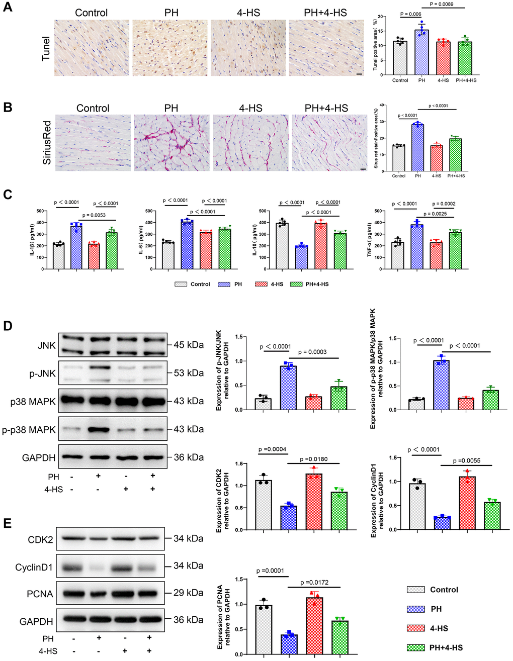 Protective effect of 4-HS on right ventricular tissue in PH rats. (A) TUNEL staining to detect the effect of 4-HS pretreatment on apoptosis in right ventricular myocardial tissue (Scale bar, 50 μm). (B) Sirius scarlet staining to detect the effect of 4-HS pretreatment on right ventricular myocardial tissue (Scale bar, 50 μm). Effect of fibrosis. (C) ELISA assay to detect changes in the expression of inflammatory factors IL-1β, IL-6, IL-10, and TNF-α in the serum of rats in each group of the experiment. (D) Western blot assay to detect changes in the expression of JNK, p-JNK, p38 MAPK, and p-p38 MAPK proteins in the tissues of pulmonary arteries in rats. (E) Western blot assay to detect changes in the expression of CDK2, CyclinD1, and PCNA proteins in the tissues of pulmonary arteries in rats.