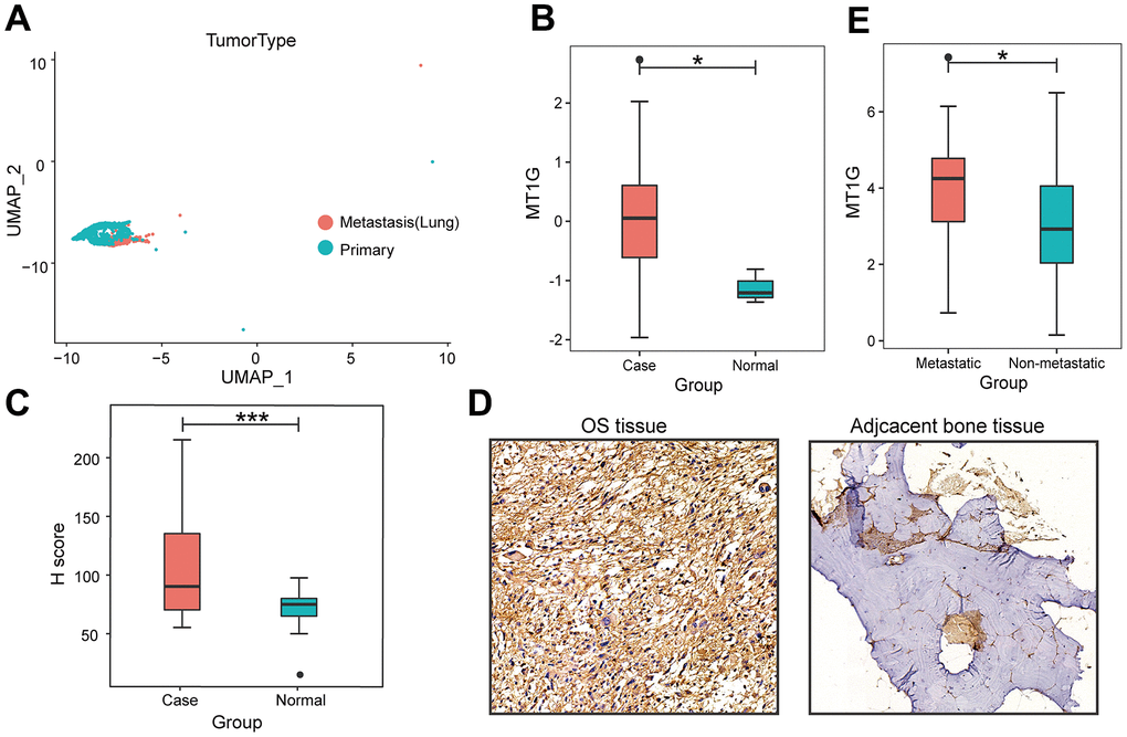 Characterization of single-cell RNA-seq profiles. (A) The clustering result of 2011 MSCs using the UMAP nonlinear dimensional reduction method colored by tissue origin. (B) MT1G was obviously more highly expressed in tumor tissues than in normal tissues. (C) In contrast to the primary tumor tissues, MT1G was obviously more highly expressed in metastatic tumor tissues. (D) Quantification of MT1G IHC staining in OS tissues (n=13) and adjacent cancerous tissues (n=13). (E) High/low H score of MT1G ICH images. (ns, p >0.05; *p 