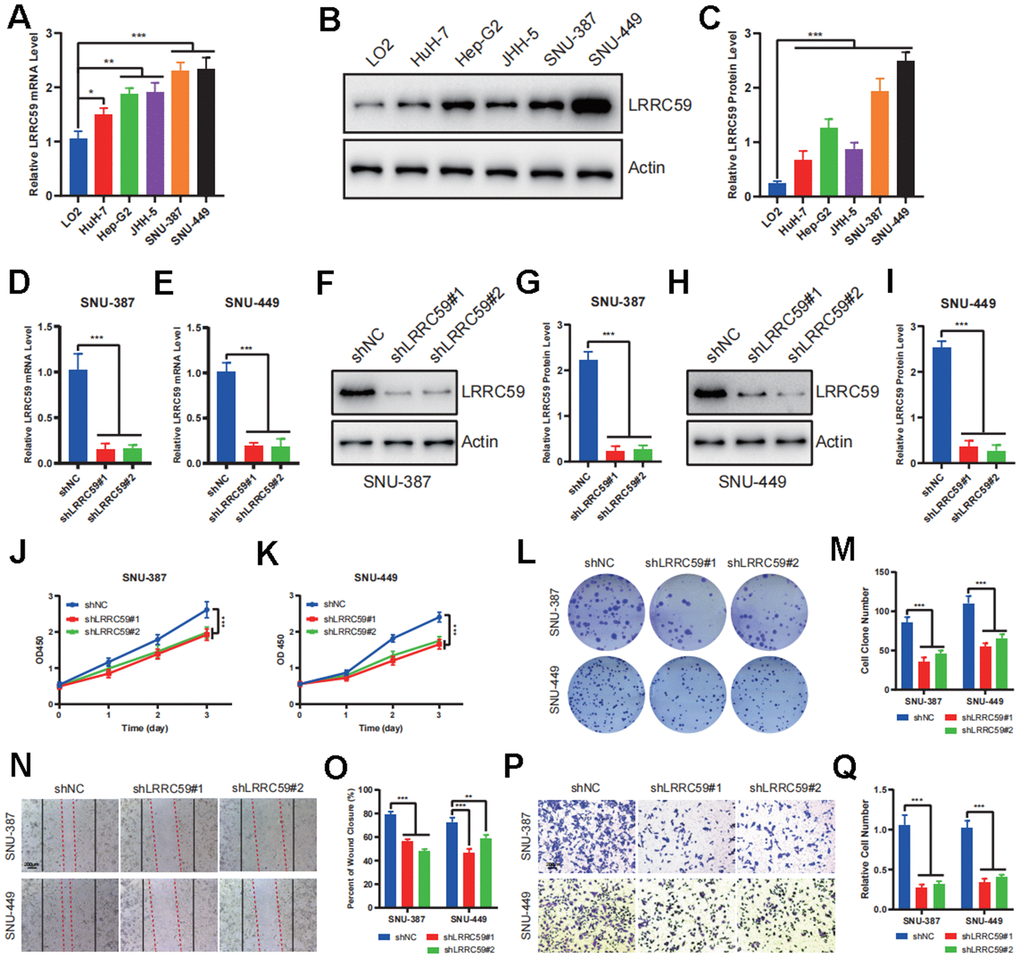 LRRC59 promotes the proliferation and migration in HCC cells. (A–C) The expression of LRRC59 was measured by qRT-PCR and western blot in HCC cells compared to normal liver cell LO2. (D, E) LRRC59 knockdown was verified by qRT-PCR in SNU-387 and SNU-449. (F–I) LRRC59 knockdown was verified by western blot in SNU-387 and SNU-449. (J, K) CCK-8 assays were used to evaluated the proliferation ability of SNU-387 and SNU-449. (L, M) Colony formation assays were used to evaluate the viability of SNU-387 and SNU-449. (N–Q) Wound healing and transwell assays were used to evaluate the migration ability of SNU-387 and SNU-449.