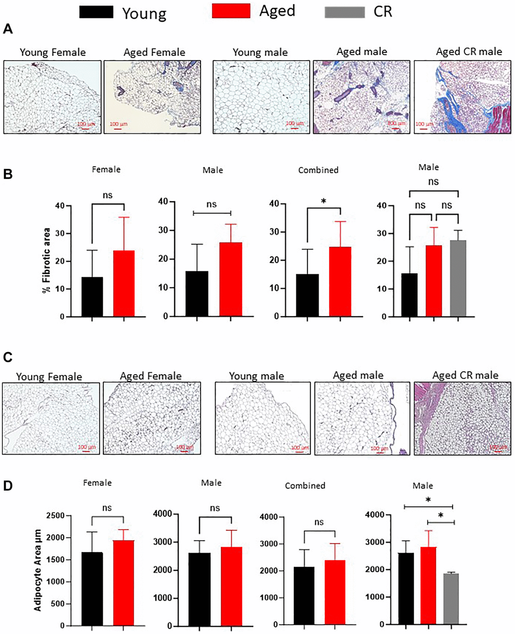 Effect of aging on adipose tissue fibrosis and adipocyte size distribution. (A, B) Masson’s Trichrome staining of adipose tissue sections (A) were quantified for staining intensity using ImageJ and plotted (B). (C, D) Adipose tissue sections from different mice groups were stained with H&E stain (C) and adipocytes size was measured using ImageJ software (D). (n = 3–5 mice per group) P-value *, ns = non-significant.