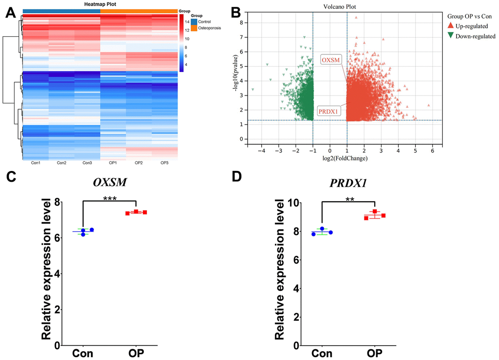 RNA-seq validation of significant disulfidptosis modulators. (A) Expression heat map and (B) volcano plot of vertebral bone tissues from patients with OP and controls, assessed by RNA-seq. (C) The disulfidptosis modulator OXSM exhibited increased expression levels in OP samples compared with controls. (D) The disulfidptosis modulator PRDX1 exhibited increased expression levels in OP samples compared with controls. All results are expressed as means ± standard deviations. **P P 