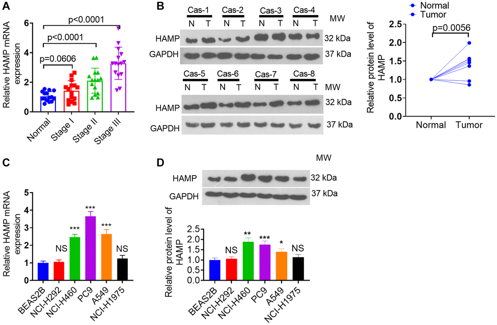 HAMP predicts a pivotal role in modulating the malignant behaviors