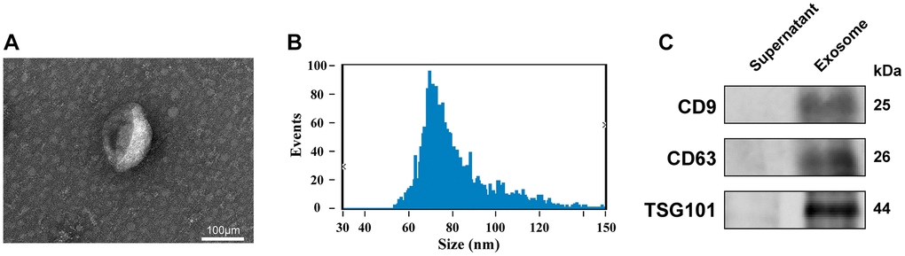 Identification of exosomes. (A) Transmission electron microscopy images of plasma exosomes (scale bar: 100 μm). (B) Size distribution measurements of exosomes by NTA detection. (C) Expression level of CD9, CD63, and TSG101 in the isolated exosomes and plasma supernatant, as quantified via WB.