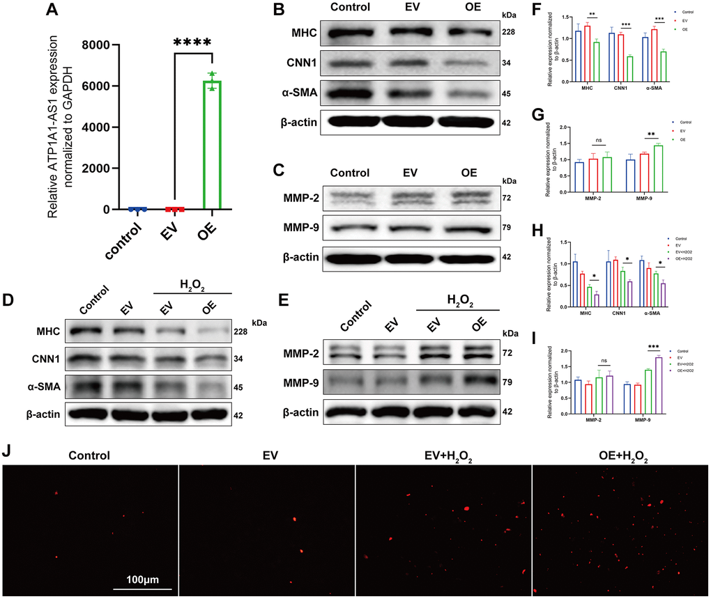 Overexpression of ATP1A1-AS1 promotes VSMC phenotype switching and apoptosis. (A) ATP1A1-AS1 mimics were used to overexpress ATP1A1-AS1 in VSMCs. The quantification of ATP1A1-AS1 expression was performed using qRT-PCR. (B, C) WB were performed to quantify the protein expression levels of contractile markers (B) and MMP-2 and MMP-9 (C) after overexpression of ATP1A1-AS1 in VSMCs. (D, E) WB was performed to detect contraction markers (D) and MMP-2 and MMP-9. (E) Protein expression levels after overexpression of ATP1A1-AS1 in pathological VSMCs, simulated using 400 μM hydrogen peroxide. (F–I) Quantification of protein expression levels. (J) TUNEL assay used to detect apoptosis after overexpression of ATP1A1-AS1 in pathological VSMCs. (*p **p ***p 