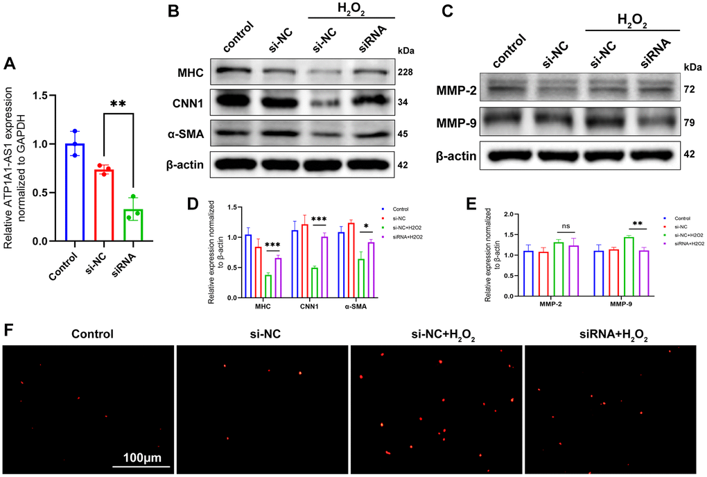 Knockdown of ATP1A1-AS1 inhibits VSMC phenotype switching and apoptosis. (A) ATP1A1-AS1 siRNA was used to knockdown ATP1A1-AS1 in VSMCs. The expression level of ATP1A1-AS1 was determined using qRT-PCR. (B, C) WB was performed to detect contraction markers proteins (B) and MMP-2 and MMP-9 (C) expression levels after knockdown of ATP1A1-AS1 in pathological VSMCs, simulated using 400 μM hydrogen peroxide. (D, E) Quantification of protein expression levels. (F) TUNEL assay used to detect apoptosis after knockdown of ATP1A1-AS1 in pathological VSMCs (*p **p ***p 
