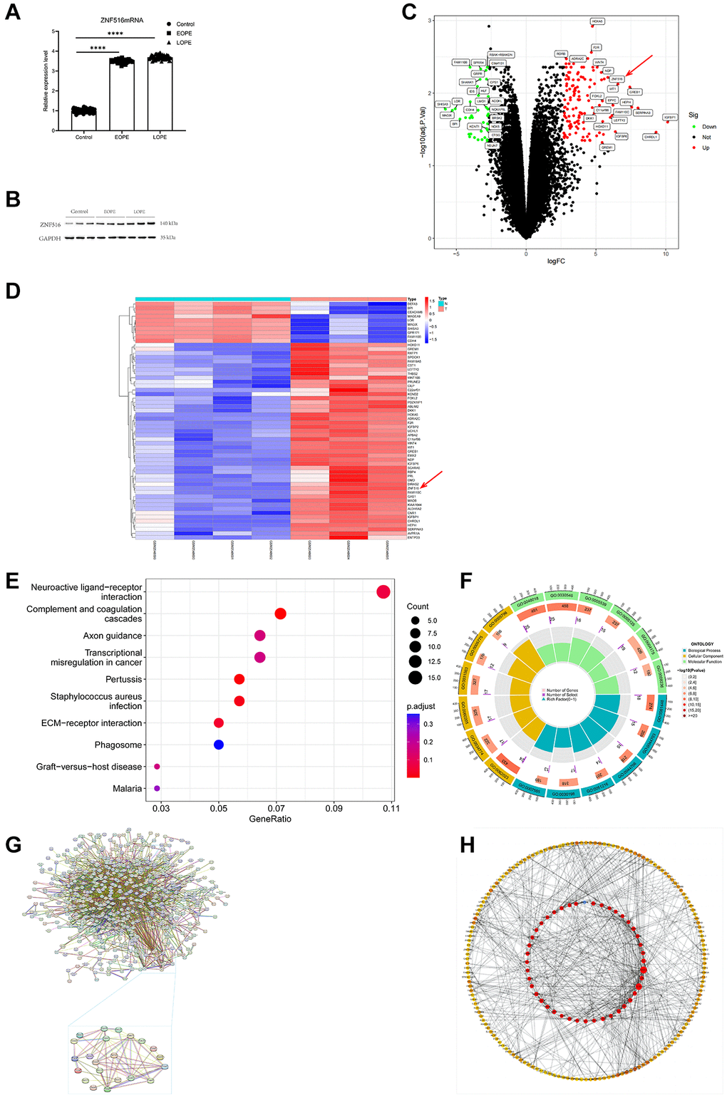 ZNF516 expression in the placentas of individuals with PE and those with pregnancies without abnormalities. (A) This study employed the RT-qPCR technique to evaluate the mRNA expression levels of ZNF516 in the placenta of both the EOPE and LOPE groups. Control, n = 71; EOPE, n = 34; and LOPE, n = 55. ****P B) Western blotting was used to assess the protein expression of ZNF516 in placental tissue. n = 3. (C, D) Volcano plot and heatmap showing the DEGs in the GSE96985 dataset. n = 308, P E) KEGG pathway analysis of the biological processes associated with the upregulated DEGs. (F) The DEGs primarily exhibit enhanced GO keywords related to biological processes, cellular components, and molecular functions. (G, H) Through the utilization of cytoHubba, the PPI network was utilized to choose the top 30 hub genes.