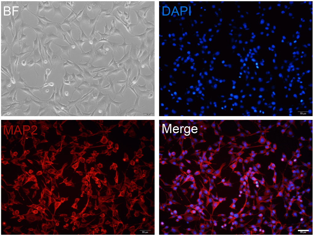 Primary cultured neuron preparation. Primary cultured hippocampal neurons are maintained at DIV12 and are observed in a bright field (BF) or stained with MAP2 (red). DAPI (blue) is used as a nuclear marker. Scale bar, 50 μm.
