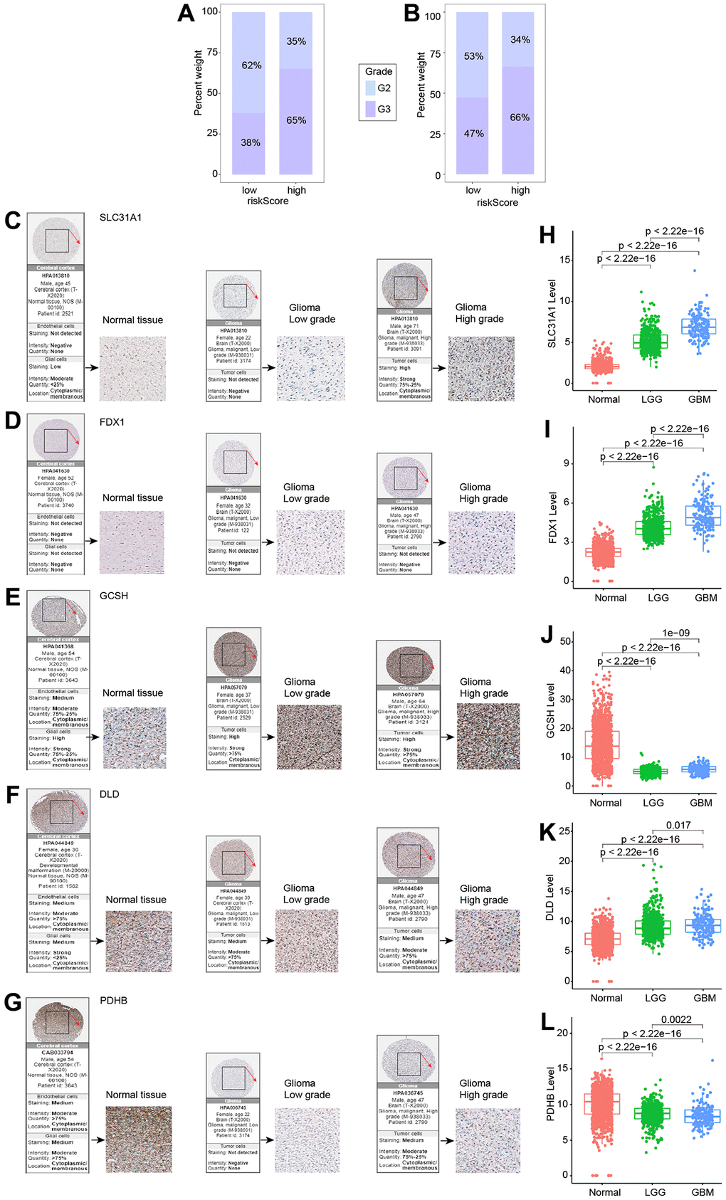 Expression of five genes in different tumor grades. (A) G2 and G3 distribution in high- and low-risk groups in the TCGA cohort. (B) G2 and G3 distribution in high- and low-risk groups in the CGGA cohort. (C–G) Five genes examined via IHC. (H–L) Expression of five genes in normal, LGG, and GBM.