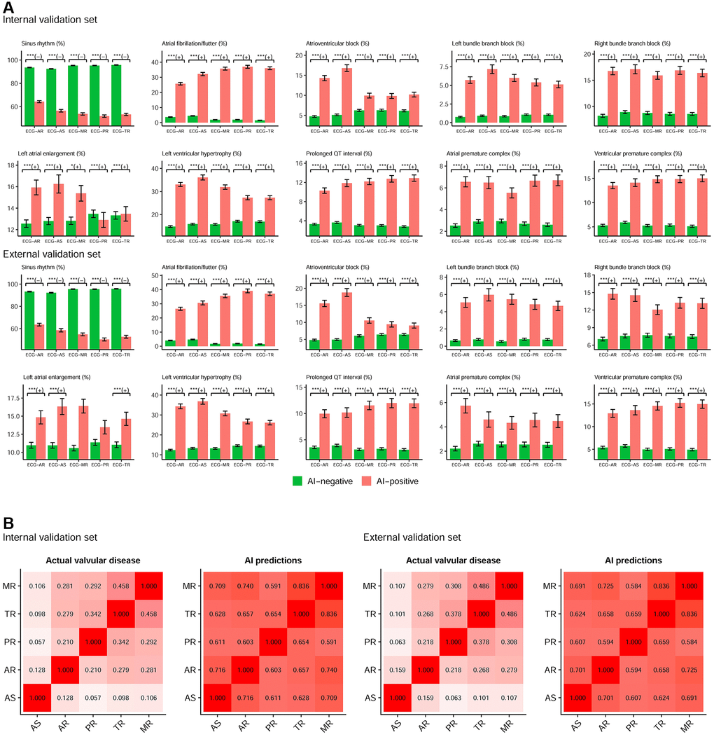 The components of AI predictions for detecting each valvular disease. (A) Relationship between ECG-screened valvular diseases and ECG rhythms. The plots display two groups, positive (AI-positive) and negative (AI-negative) findings, by the ECG networks using ECG alone. Sinus rhythm is associated with AI-negative (green bar), and other abnormal rhythms are associated with AI-positive (red bar). Abbreviations: *p **p ***p B) The relationship between each valvular disease in actual status and prediction. The values in each cell are the Spearman correlation coefficients.