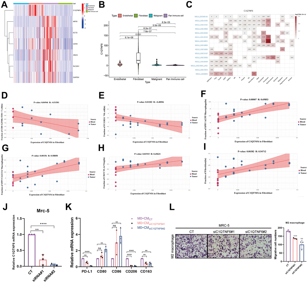 Effect of C1QTNF6 on infiltrating immune cells of TME. (A) The heatmap of 7 genes expression in different cells by scRNA-seq. (B) The differences of C1QTNF6 expression among pan-immune cells, endothelial cells, fibroblasts and malignant cells. (C) The heatmap of C1QTNF6 expression in TME cells by multiple scRNA-seq datasets. The correlation of C1QTNF6 expression in fibroblasts and immune cells infiltration (memory CD8+ T cell (D), NK cell (E), M2 macrophages (F, G), Treg cell (H), fibroblast (I)). (J) qRT-PCR was performed to detect the efficiency of C1QTNF6-siRNA transfection. (K) M0 macrophages were stimulated by conditional medium from MRC-5 cells with C1QTNF6 silencing for 48h. qRT-PCR was performed to detect the expression of PD-L1, M1 and M2 markers. (L) Representatives and summary of M2 macrophage migration assays induced with MRC-5 cells with or without C1QTNF6 silencing. The data were presented as the mean±SD; n = 3. *P P P 