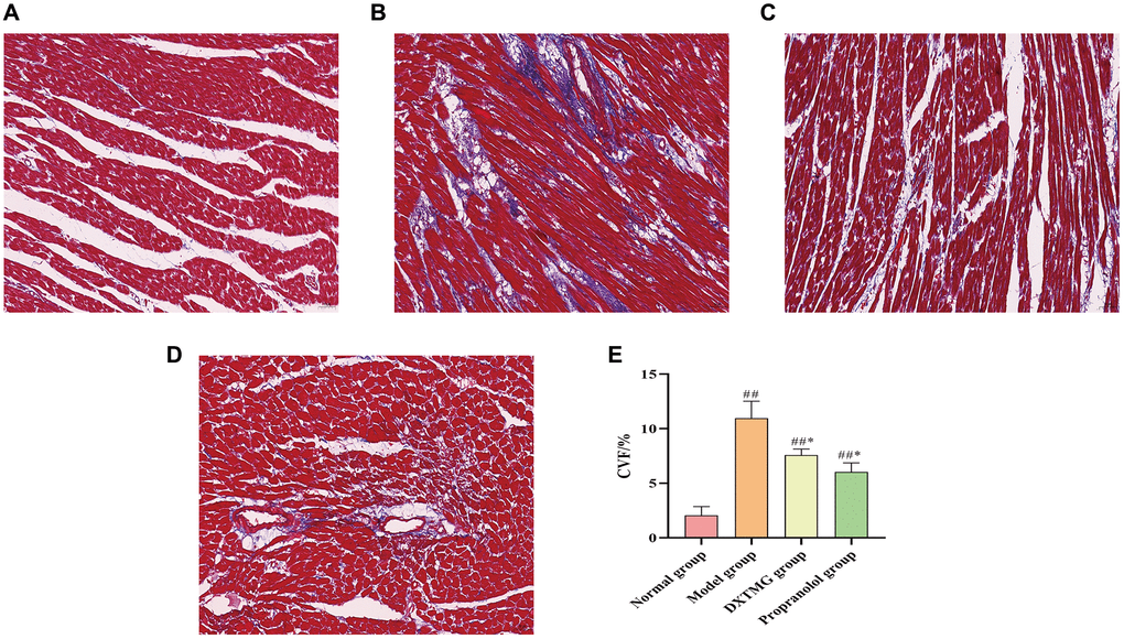 Morphology of rat cardiomyocytes in each group (Masson staining, ×20). (A) Blank group; (B) Model group; (C) DXTMG group; (D) Propranolol group; (E) Comparison of CVF in rats of various groups.