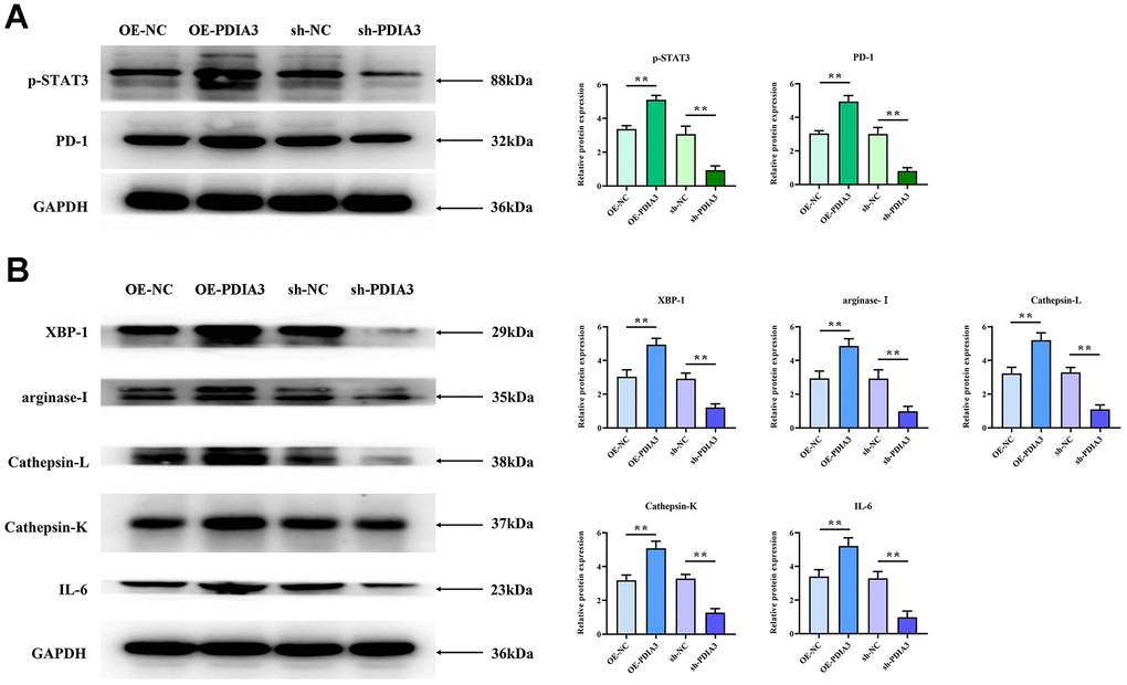 PDIA3 facilitates M2 polarization of tumor-associated macrophages and augments tissue protease secretion through modulation of STAT3/PD-1 signaling. (A) Comparison of p-STAT3 and PD-1 protein levels in cells with PDIA3 overexpression versus or-NC control, and PDIA3 knockdown versus sh-NC control, as determined by western blot (n=3 per group). Statistical evaluation via Ttest,* *P B) Protein expression of XBP-1, arginase-1, cathepsin-L, cathepsin-K, and IL-6 in PDIA3-altered THP-1 cells, assessed by western blot (n=3 per group). Statistical evaluation via T-test,* *P 