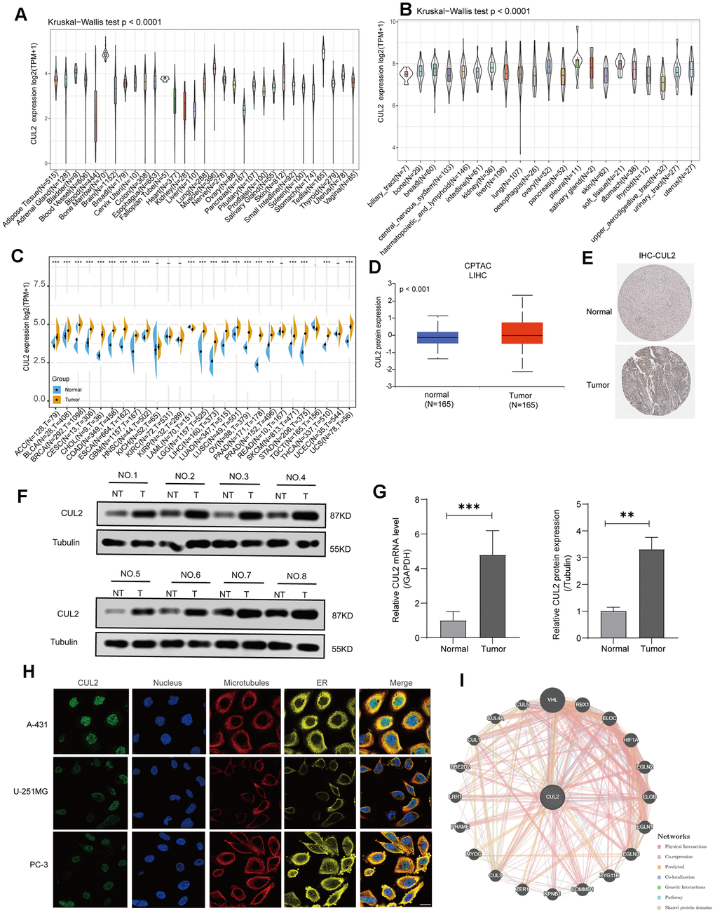 CUL2 expression analysis in various cancers. (A) The level of CUL2 expression in normal tissues. (B) The level of the CUL2 in tumor cell lines. (C) A comparative analysis of CUL2 expression levels between various tumors and healthy tissues was conducted using TCGA and GTEx databases data. The box plot data was provided, and Log2 (TPM+1) was used to represent the log scale. (D) The CUL2 protein expression in LIHC is based on the CPTAC website. (E) Representative images from the HPA database depict immunohistochemical staining analysis of CUL2 in LIHC tissue and adjacent normal tissue are displayed. (F, G) The protein and mRNA levels of CUL2 were analyzed via Western blotting and qRT-PCR in paired LIHC tissues and adjacent normal tissues. (H) The immunofluorescence images showed the distribution of CUL2 in the A-431, U-251MG, and PC-3 cell lines. (I) The protein-protein interaction (PPI) network presents the proteins interacting with CUL2. All data are presented as the mean ± SD of three independent experiments. *p p p 