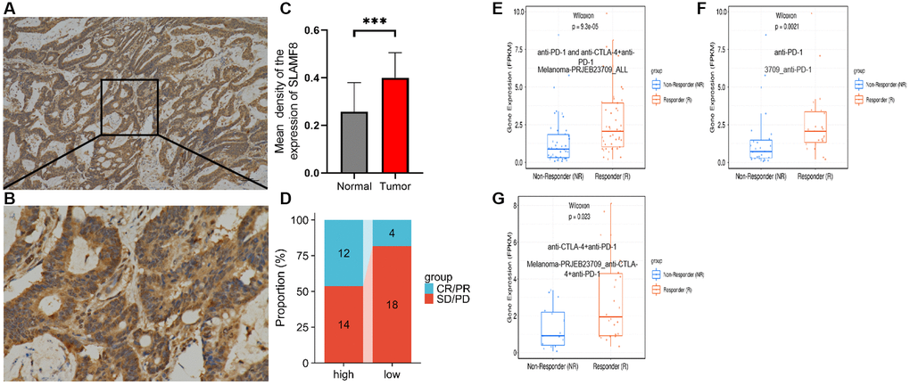 Correlation analysis between SLAMF8 expression and immunotherapy. (A) Representative immunohistochemical staining of SLAMF8 in STAD tissue, Magnification ×100. (B) Representative immunohistochemical staining of SLAMF8 in STAD tissue, Magnification ×400. (C) Different expression of SLAMF8 in STAD tissue and matched adjacent noncancerous tissues. ***P D) Different therapeutic effectiveness of albumin paclitaxel combined with Sindillizumab between high expression of SLAMF8 and low expression of SLAMF8 in 48 patients who were recurrent after radical gastric cancer surgery. (E–G) Correlation analysis between SLAMF8 expression and the therapeutic effectiveness of immunotherapy based on Melanoma-PRJEB23709
