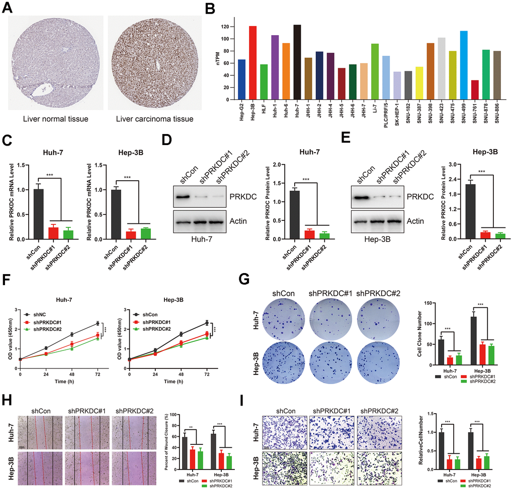 PRKDC knockdown represses the invasiveness of LIHC cells. (A) PRKDC expression in LIHC tissues from protein atlas. (B) PRKDC expression in LIHC cell lines from protein atlas. (C) Expression of PRKDC mRNA in Huh-7 or Hep-3B using qPCR. (D, E) Protein level of PRKDC in Huh-7 or Hep-3B using WB. (F) Cell viability in PRKDC knockdown and negative control groups. (G) Clone formation assays between PRKDC knockdown and negative control groups. (H) Would healing assays between PRKDC knockdown and negative control groups. (I) Relative migration of Huh-7 or Hep-3B cells between PRKDC knockdown and negative control groups.