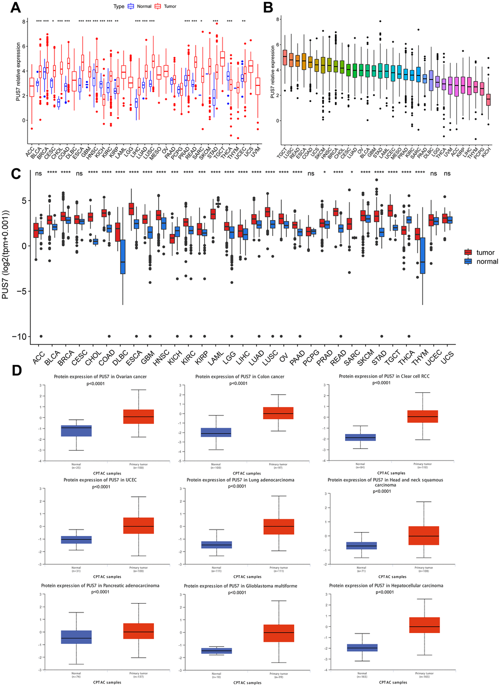 Differential expression of PUS7 in pan-cancer. (A) Comparison of PUS7 expression between tumor and normal samples in TCGA database. (B) Expression of PUS7 in tumor tissue for 33 cancer types. (C) Comparison of PUS7 expression between tumor and normal samples in TCGA and GTEx database. (D) Comparison of PUS7 protein level between tumor and normal samples.