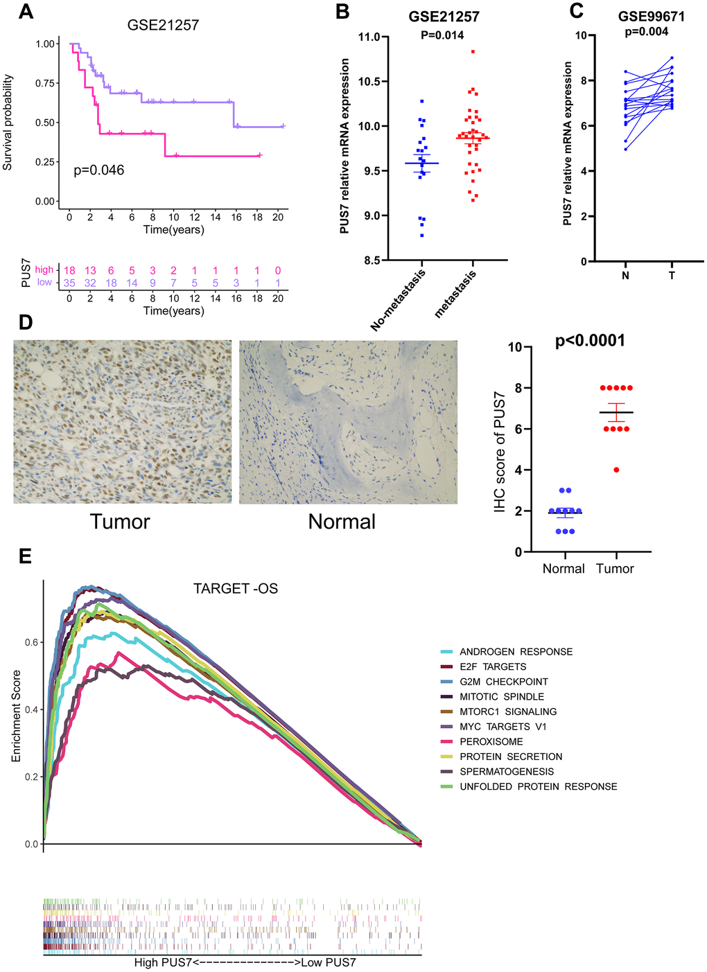 PUS7 as a promising biomarker in osteosarcoma. (A) Kaplan–Meier analysis of the association between PUS7 expression and OS in GSE21257. (B) Comparison of PUS7 expression between non-metastasis and metastasis samples in osteosarcoma. (C) Comparison of PUS7 expression between tumor and normal samples in osteosarcoma. (D) The expression value of PUS7 in osteosarcoma tissue and adjacent normal specimens determined by IHC analysis. (E) The GSEA analysis between PUS7-high and-low groups in the Target-OS cohort.