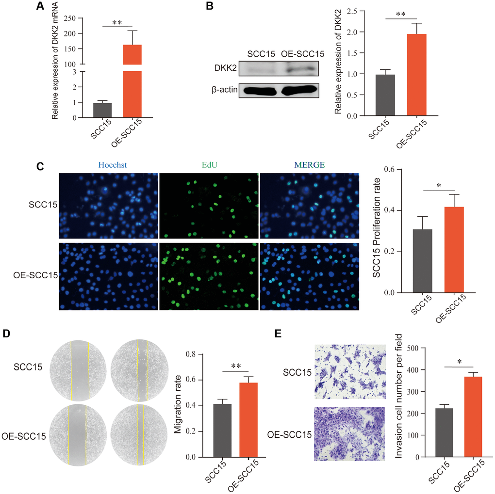 Overexpression of DKK2 and the progression of oral squamous cell carcinoma. (A) Reverse transcription-quantitative polymerase chain reaction was used to verify the overexpression efficiency of the SCC15 cell line. (B) Western blot was used to detect the overexpression efficiency of SCC15 cell line. (C) After overexpression of DKK2, the proliferation of transfected SCC15 cell line was detected using EdU assay. (D) After overexpression of DKK2, the migration of cells was detected using scratch assay. (E) After overexpression of DKK2, the invasion of cells was detected using Transwell assay. *p **p ***p ****p 