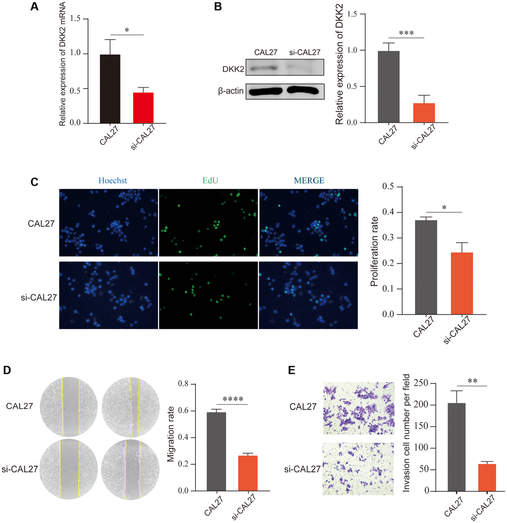Knockdown of DKK2 can reduce the progression of oral squamous cell carcinoma. (A) Reverse transcription-quantitative polymerase chain reaction was used to verify the knockdown efficiency of CAL27 cell line. (B) Western blot was used to detect the knockdown efficiency of CAL27 cell line. (C) After knockdown of DKK2, EdU assay was used to detect the proliferation of transfected CAL27 cell line. (D) After knockdown of DKK2, scratch assay was used to detect the migration of cells. (E) After knockdown of DKK2, Transwell assay was used to detect the invasion of cells. *p **p ***p ****p 