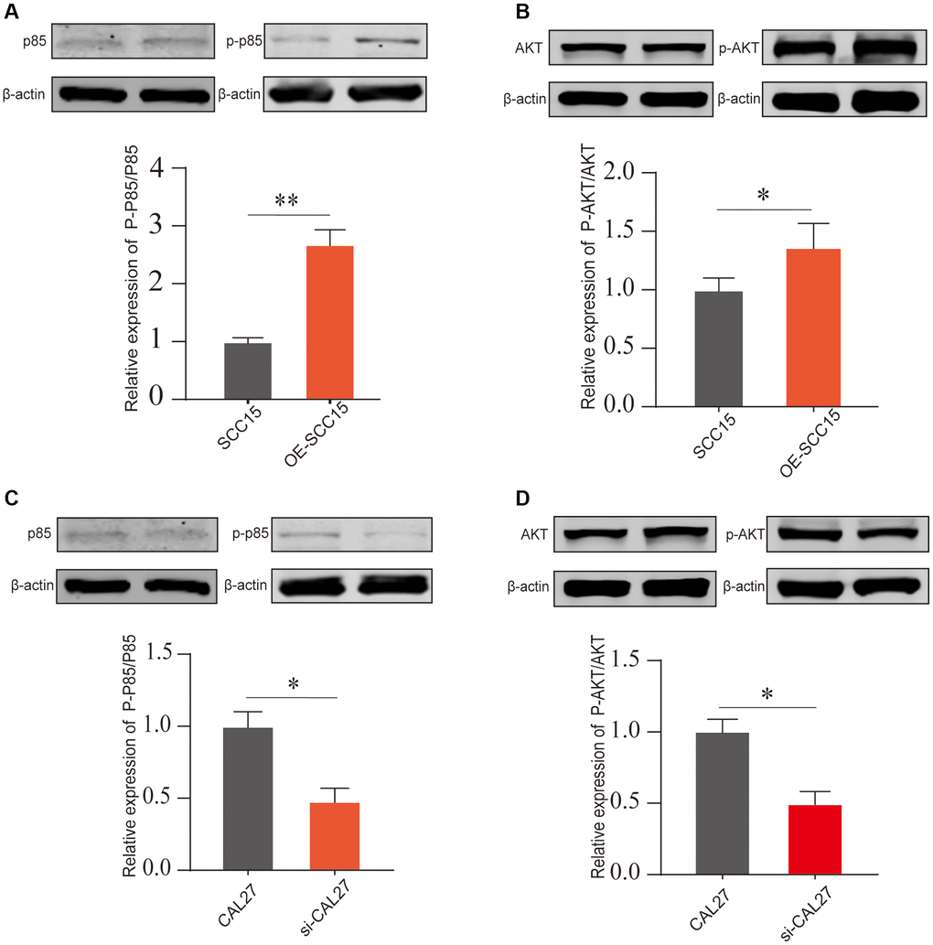 The PI3K/AKT pathway activation after DKK2 knockdown/overexpression. (A, B) After overexpressing DKK2 in SCC15 cells, the activation of the PI3K/AKT pathway was detected by Western blot assay. (C, D) After knocking down DKK2 in CAL27 cells, the activation of the PI3K/AKT pathway was detected by Western blot assay. *p **p ***p ****p 