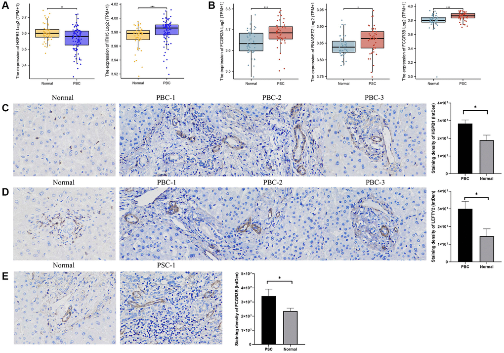 Validation of external dataset and IHC experiment. (A) Expression levels of HSPB1 and ITIH5 between PBC and control groups in GSE119600 dataset; (B) Expression levels of FCGR2A, FCGR3B, and RNASET2 between PSC and control groups in GSE119600 dataset; (C) IHC staining of HSPB1 encoding proteins in liver samples of PBC patients and normal individuals; (D) IHC staining of LEFTY2 encoding proteins in liver samples of PBC patients and normal individuals (E) IHC staining of FCGR3B encoding proteins in liver samples of PSC patients and normal individuals. Abbreviations: IHC: immunohistochemistry; PBC: primary biliary cholangitis; PSC: primary sclerosing cholangitis. *p-value **p-value ***p-value 