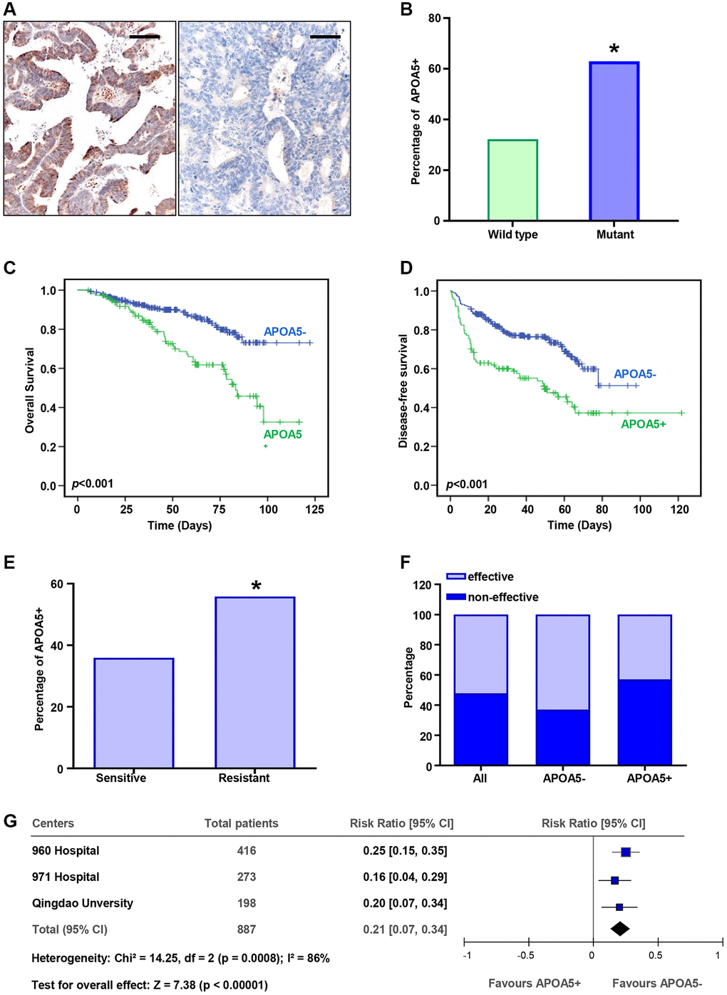 APOA5 expression estimates poor prognosis and chemotherapy resistance in CRC patients. (A) The APOA5 protein was observed in the cytoplasm of CRC cells, which was analyzed with IHC staining. Bar = 50 μm. (B) The percentage of APOA5 positive expression in the specimens with wild-type PIK3CA or mutant ones. (C, D) Kaplan-Meier analysis of the disease-free survival (DFS, D) and overall survival (OS, C) between APOA5 positive and negative tumors in 378 CRC patients. P-value was obtained from two-sided log-rank tests. (E) The percentage of APOA5 expression in the patients effective and resistant to first-line chemotherapy. (F) Chemotherapy responses among patients with APOA5 positive and negative tumors. (G) The hazard ratio of APOA5 expression for chemotherapy resistance in three independent cohorts was analyzed with forest plot. The size of each square is proportional to the number of patients in each cohort. The area of the squares reflects the study-specific weight. Horizontal lines represent 95% confidence intervals (CI). Diamonds represent the pooled risk ratio and 95% CI of APOA5 expression. p-values *.