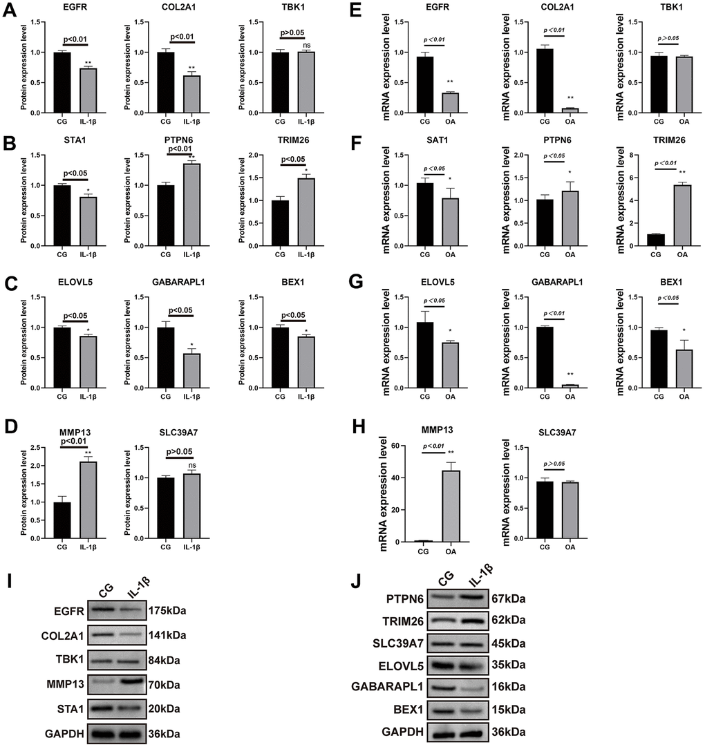 Results of real-time PCR and Western blot analysis. The SW1353 cell line was divided into two groups: normal chondrocytes and those with the addition of interleukin 1β (10ng/ml) intervention. The results of COL2A1 and MMP13 with GAPDH as an internal control (A–D) and real-time PCR was performed to measure the relative mRNA expression of inflammatory genes/proteins in OA (E–H). Western blotting analysis of nine key genes in two groups (I, J).