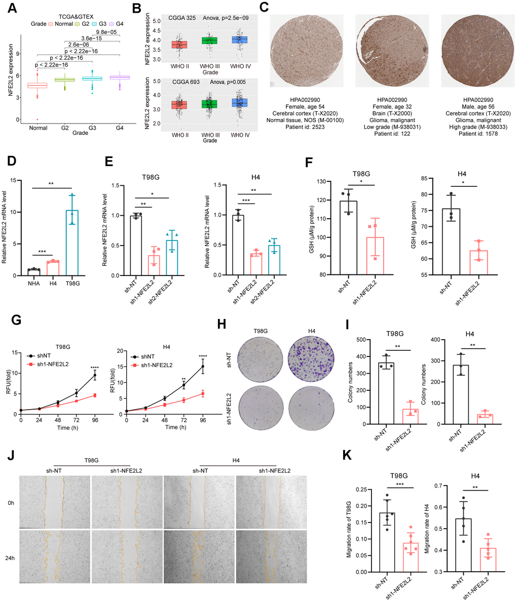 Expression analysis and biological function assessment of NFE2L2. (A) NFE2L2 expression in normal tissues and gliomas was examined using TCGA and GTEx data. (B) Quantification of NFE2L2 expression levels from CGGA datasets. (C) Typical IHC images of NFE2L2 expression in the HPA database. (D) qRT-PCR analysis of NFE2L2 mRNA expression in human astrocytes (NHA) and glioma cell lines (H4, T98G). (E) Validation of NFE2L2-specific shRNA knockdown efficiency in T98G and H4 cell lines by qRT-PCR. (F) Assessment of glutathione levels in T98G and H4 cells after NFE2L2 knockdown. (G) Impact of NFE2L2 knockdown on the proliferation of T98G and H4 cells. (H) Colony formation in response to NFE2L2 knockdown in T98G and H4 cell lines. (I) Histograms showing the number of colonies. (J) Scratch experiments revealing the effect of NFE2L2 knockdown on the migratory capacity of T98G and H4 cell lines. (K) Histograms showing the migration rate (N=5 or N=6). All data points were presented as mean ± SD, from three to six independent experiments.