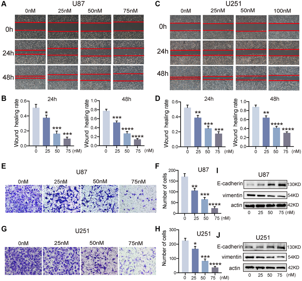 Bufotalin attenuated the EMT process of GBM cells. (A–D) The effect of bufotalin on U87 and U251 migration was assessed by wound healing assay at 24 h and 48 h. (E–H) The effect of bufotalin on U87 and U251 invasion was assessed by Transwell assay. (I, J) The expression levels of E-cadherin and Vimentin were analyzed by western blot. The data are representatives of three independent experiments and are presented as the mean ± SD. Significant differences compared with the control are indicated by *p **p ***p ****p 
