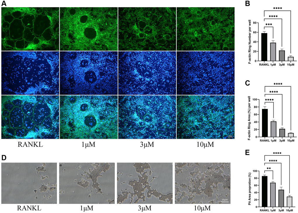Inhibition of osteoclast function by CL. (A) The F-actin ring image from BMMs treated with CL under osteoclast induction condition. (B, C) The number and area quantifying of F-actin ring. (D) The bone resorption pits image form osteoclast treated with CL. (E) The area quantifying of bone resorption pits. **P ***P ****P 