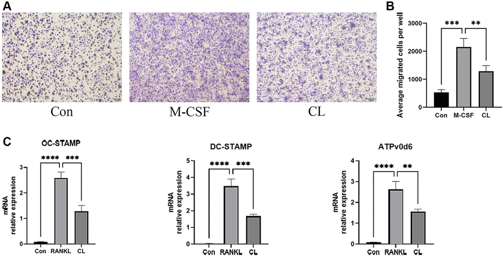 Inhibition of pre-osteoclast migration and fusion by CL. (A) The crystal violet staining image from pre-osteoclast treated with CL. (B) The number quantifying of migrated cells. (C) The analysis of the relative mRNA levels of OC-STAMP, DC-STAMP, and ATPv0d6. **P ***P ****P 