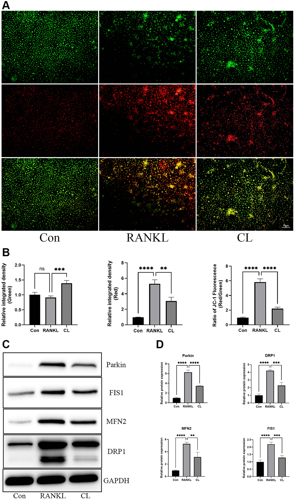 Inhibition of mitochondrial function by CL. (A) The JC-1 staining image from BMMs treated with CL under osteoclast induction condition. (B) The membrane potential quantifying of mitochondria. (C) The protein band image of Parkin, DRP1, FIS1, and MFN2. (D) The expression quantifying of Parkin, DRP1, FIS1, and MFN2. The ns, not statistically significant; **P ***P ****P 