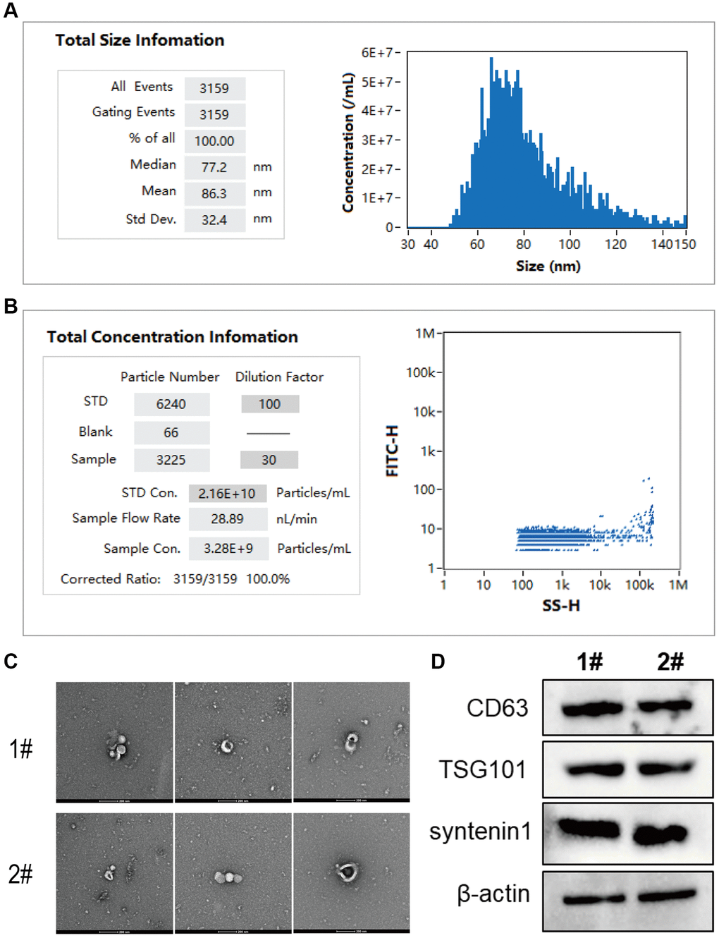 Extraction and identification of exosomes from rabbit serum for biological activity. (A) The analysis of exosome particle size using nanoscale flow cytometry; (B) The analysis of exosome concentration. (C, D) Transmission electron microscopy images of exosomes in serum samples from rabbit models with femoral fractures, where C shows the exosome suspension at dilutions of 10, 30, and 50-fold from left to right, and D illustrates the protein expression of CD63, TSG101, and syntenin1 in exosomes from the serum of rabbit models with femoral fractures.
