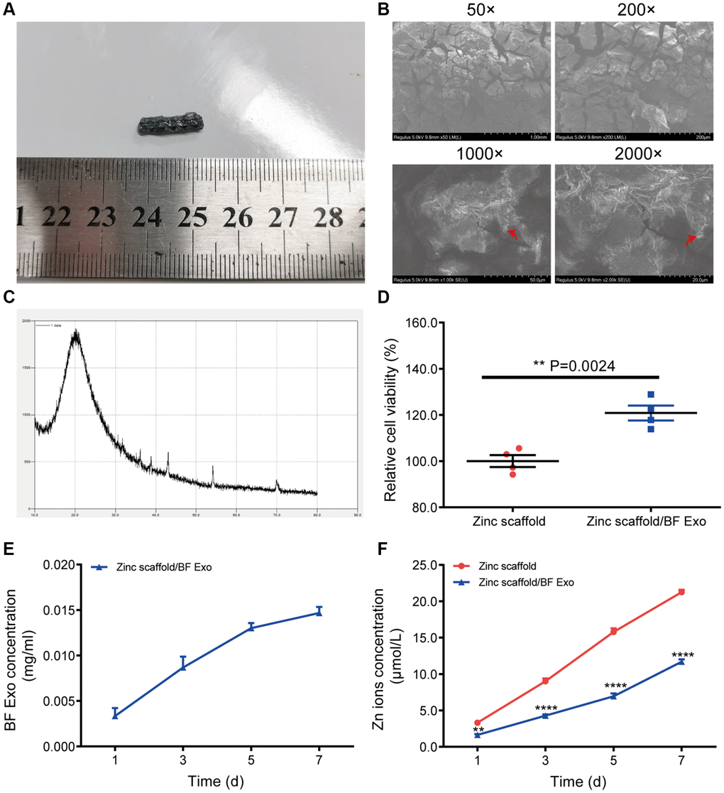 Preparation of zinc scaffold/BF Exo composite implant. (A) Solid images of degradable zinc stent/BF Exo composite implant; (B) Electron microscopy images of degradable zinc stent/BF Exo composite implant at 50, 200, 1000, and 2000 times magnification, with red arrows indicating small amounts of exosomes encapsulated in the gel; (C) X-ray diffraction patterns of degradable zinc stent/BF Exo composite implant; (D) CCK-8 experiment results after co-culturing BMSCs cells with degradable zinc stent/BF Exo composite implant for 3 days; (E) In vitro release results of exosomes from zinc stent/BF Exo composite implants after incubation for 1, 3, 5, and 7 days; (F) In vitro release results of zinc ions after incubating two types of stents for 1, 3, 5, and 7 days (**P ****P n = 3).