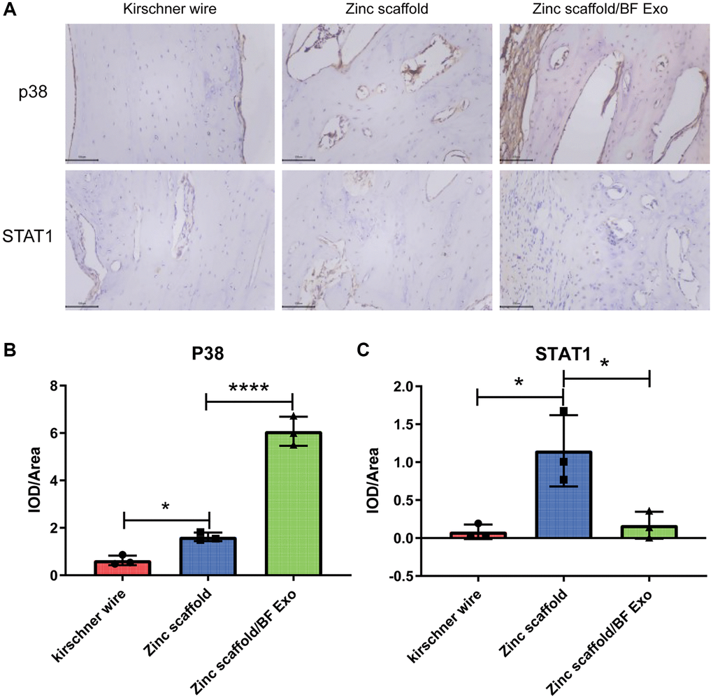 Immunohistochemical analysis of in vivo implantation of zinc scaffold/BF Exo composite implant. (A) Immunohistochemical staining results of rabbit radius in each group after 12 weeks of modeling; (B) Quantitative analysis results of p38 in rabbit radius in each group after 12 weeks of modeling; (C) Quantitative analysis results of STAT1 in rabbit radius in each group after 12 weeks of modeling (*P ****P nsP > 0.05 vs. Zinc scaffold, n = 3).