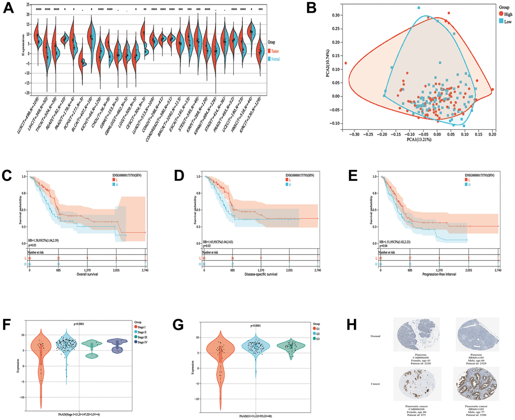 14-3-3σ expression in PAAD and its predictive value for prognosis. (A) The expression levels of 14-3-3σ mRNA in pan-cancer. (B) The principal component analysis (PCA) analysis assessed the grouping situation of patients with different levels of 14-3-3σ expression. The K-M survival curves are plotted to predict the overall survival (OS) (C), disease-specific survival (DSS) (D), and progression-free interval (PFS) (E) of the American Type Culture Collection (TCGA) patients. The expression of 14-3-3σ in PAAD tissues in patients with different Stages (F) and Grade (G). (H) Immunohistochemistry (IHC) results of the expression levels of 14-3-3σ between PAAD and para-carcinoma tissues according to the Human Protein Atlas (HPA) database.