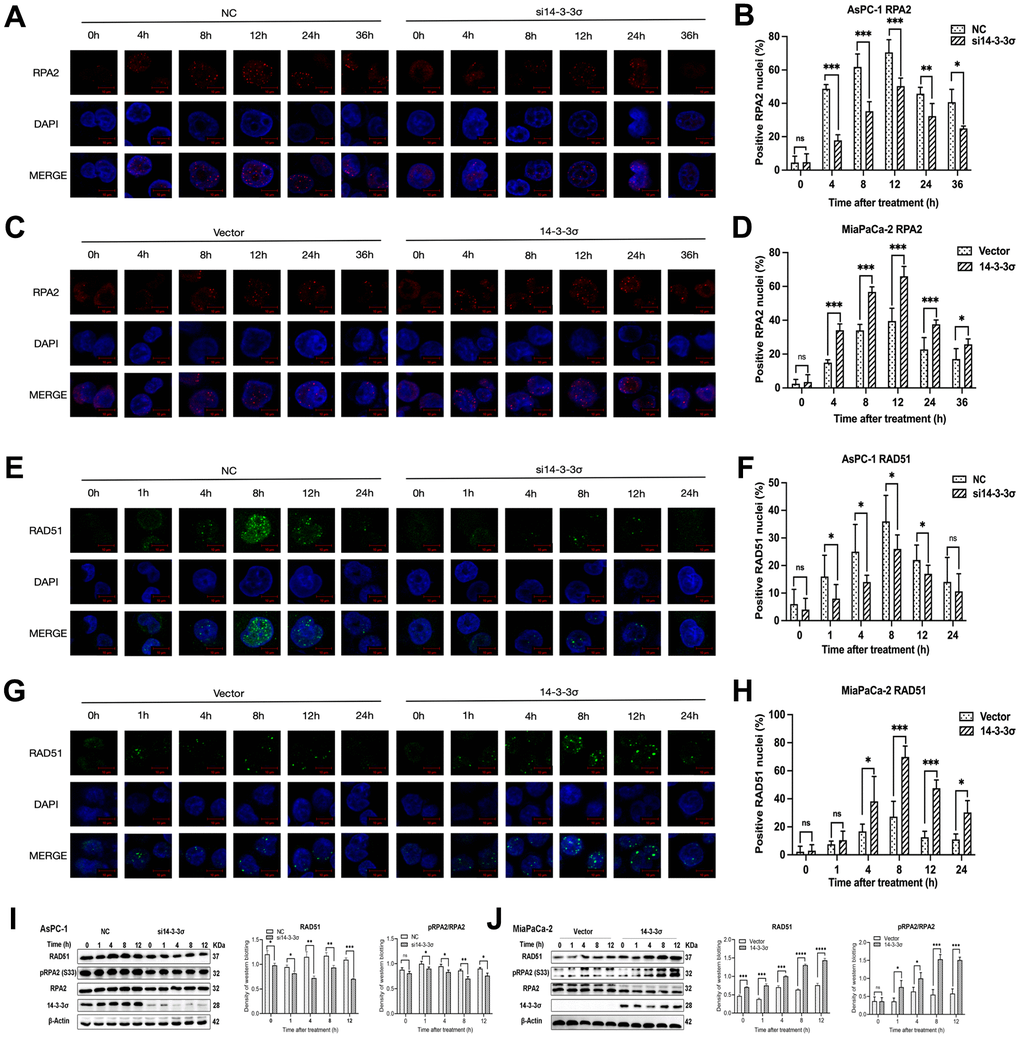 14-3-3σ enhances the HR pathway activation. (A) The representative images of the RPA2 foci in AsPC-1 cells after 3 Gy carbon ion irradiation in different groups were analyzed by immunofluorescence (IF) staining. (B) Percentage of positive nuclei of RPA2 in AsPC-1 cells in different groups (5 foci or more per nucleus being considered positive). (C) The representative images of the RPA2 foci in MiaPaCa-2 cells after 3 Gy carbon ion irradiation in different groups were analyzed by IF staining. (D) Percentage of positive nuclei of RPA2 in MiaPaCa-2 cells in different groups (5 foci or more per nucleus being considered positive). (E) The representative images of the RAD51 foci in AsPC-1 cells after 3 Gy carbon ion irradiation in different groups were analyzed by IF staining. (F) Percentage of positive nuclei of RAD51 in AsPC-1 cells in different groups (5 foci or more per nucleus being considered positive). (G) The representative images of the RAD51 foci in MiaPaCa-2 cells after 3 Gy carbon ion irradiation in different groups were analyzed by IF staining. (H) Percentage of positive nuclei of RAD51 in MiaPaCa-2 cells in different groups (5 foci or more per nucleus being considered positive). (I) Relative protein expression of RAD51, pRPA2, RPA2 in si14-3-3σ and NC AsPC-1 cells, 0 h, 1 h, 4 h, 8 h, and 12 h post-irradiation. (J) Relative protein expression of RAD51, pRPA2, RPA2 in 14-3-3σ-overexpression and vector MiaPaCa-2 cells, 0 h, 1 h, 4 h, 8 h, and 12 h post-irradiation. For IF, at least 100 cells per condition were analyzed. Data were presented as the mean ± standard deviation (SD). *p 