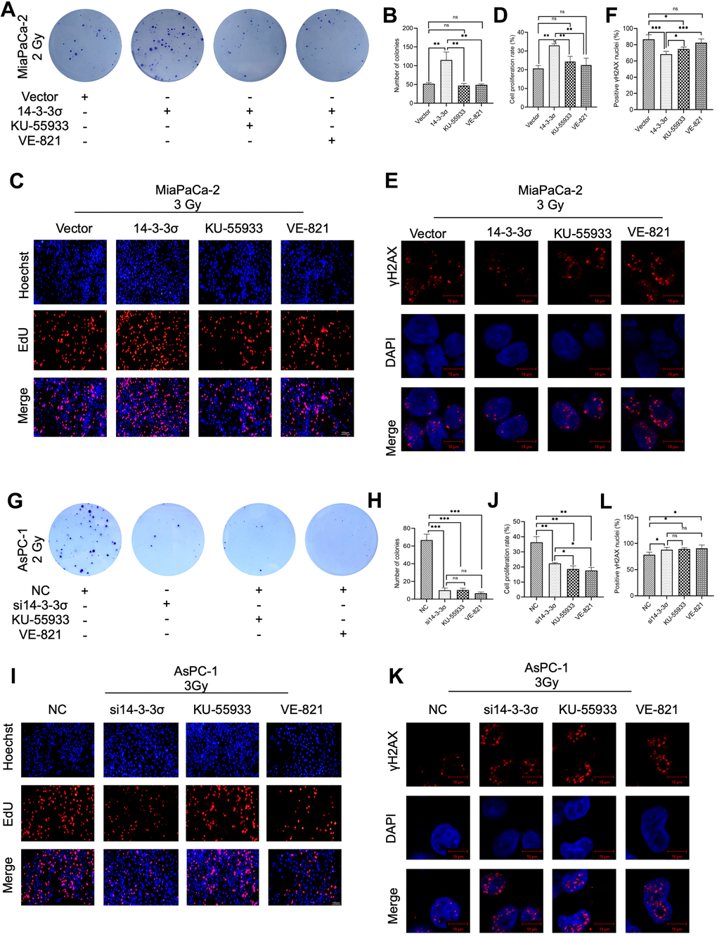 Pharmacological inhibition of the HR pathway abolishes 14-3-3σ-mediated carbon ion irradiation resistance. Colony formation assay (A, B), EdU assay (C, D), and immunofluorescence (IF) staining of γH2AX 1 h (E, F) in MiaPaCa-2 cells after 2 Gy carbon ion irradiation in different groups: vector group (empty vector), 14-3-3σ group (14-3-3σ overexpression), KU-55933 group (14-3-3σ overexpression + KU-55933 [inhibitor of ATM, 10μM, dissolved in DMSO]), and VE-821 group (14-3-3σ overexpression + VE-821 [inhibitor of ATR, 10μM, dissolved in DMSO]). Colony formation assay (G, H), EdU assay (I, J), and IF staining of γH2AX 1 h (K, L) in AsPC-1 cells after 2 Gy carbon ion irradiation in different groups: NC group (negative control), si14-3-3σ group (14-3-3σ knockdown), KU-55933 group (NC + KU-55933 [inhibitor of ATM, 10μM, dissolved in DMSO]), and VE-821 group (NC + VE-821 [inhibitor of ATR, 10μM, dissolved in DMSO]). For IF, at least 100 cells per condition were analyzed. Data were presented as the mean ± standard deviation (SD) (n=3); *p p p p 
