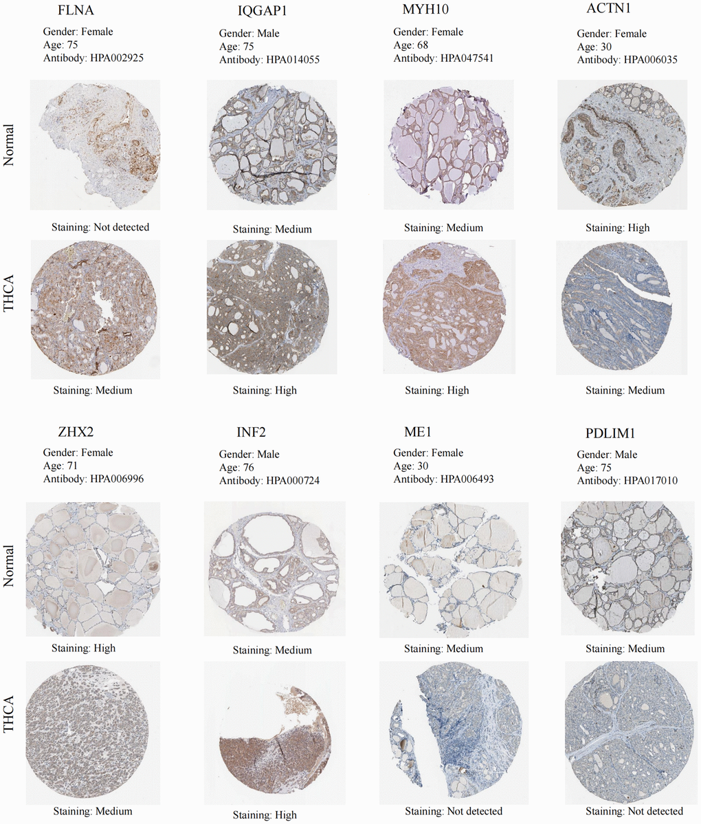 IHC of the DEDRGs in the HPA database.
