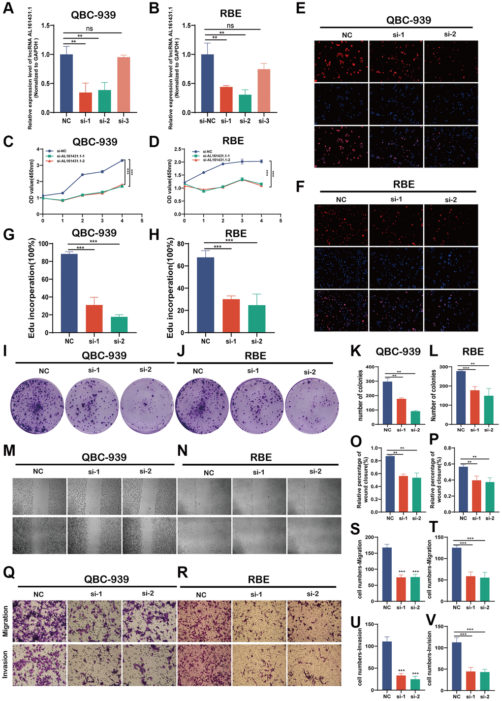 AL161431.1 promotes CCA cell proliferation, migration and invasion in vitro. (A, B) Expression levels of AL161431.1 in QBC-939 and RBE cells treated with three siRNA. (C–L). Cell proliferation detection of QBC-939 and RBE cells were measured by CCK-8, EDU assay and clone formation (magnification, x100, scale bar, 100 um). (M–V). Cell migratory and invasive capabilities were assessed by wound healing assays and transwell assays in QBC-939 and RBE cells transfected with NC, si- AL161431.1-1 and si- AL161431.1-2 (magnification, ×100, scale bar, 100 μm). nsp ≥ 0.05, *p **p ***p ****p 