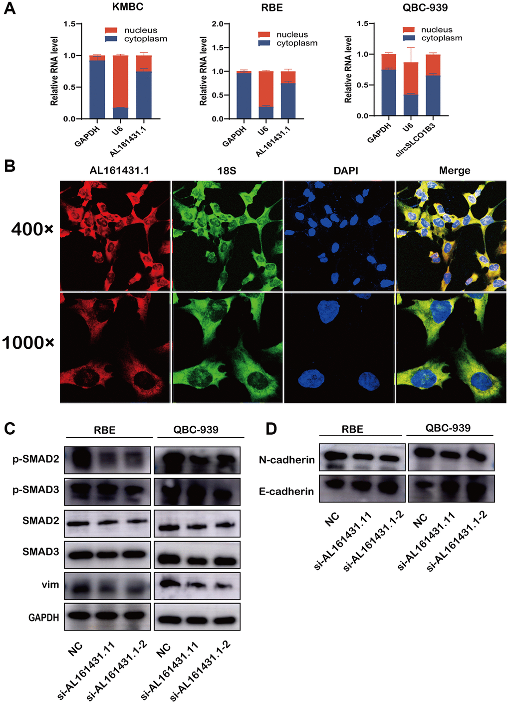 AL161431.1 activates TGF-β/SMAD Pathway to promote EMT and its cellular location. (A) qRT-PCR was used to measure the level of AL161431.1 in the nuclear and cytoplasmic of KMBC, QBC-939 and RBE cells. (B) FISH was performed to observe the cellular location of AL161431.1(red) and 18s(green) in RBE cells (magnification, ×400, scale bar, 20 μm and magnification, ×1000, scale bar, 10 μm). (C) Western blotting showed expression of different TGF-β/SMAD Pathway proteins and epithelial and mesenchymal after silencing AL161431.1 in QBC-939, and RBE cells. (D) Western blotting showed expression of epithelial and mesenchymal proteins after silencing AL161431.1 in QBC-939, and RBE cells.