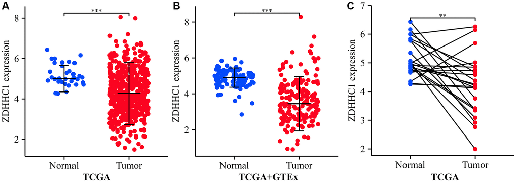 ZDHHC1 expression in normal endometrial and UCEC tissues. (A) TCGA database. (B) Xena database. (C) TCGA database. Abbreviations: UCEC: uterine corpus endometrial carcinoma; ZDHHC1: zinc finger DHHC-type containing 1; TCGA: The Cancer Genome Atlas; GTEx: Genotype-Tissue Expression.